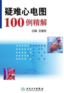 亏损总部补助会计分录