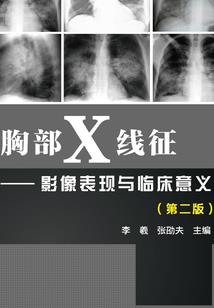 免税蔬菜会计分录
